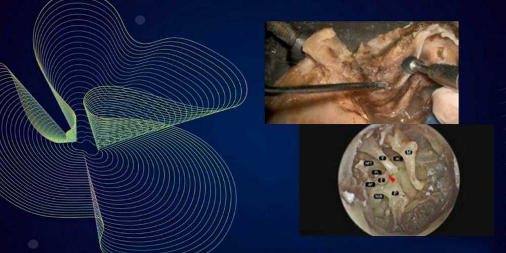 Tarjeta del curso: Disección de Hueso Temporal